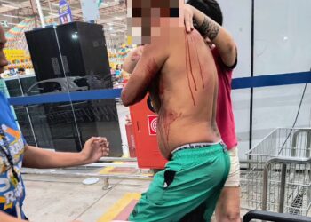 Homem é atingido por golpes de faca no pescoço dentro de supermercado na capital