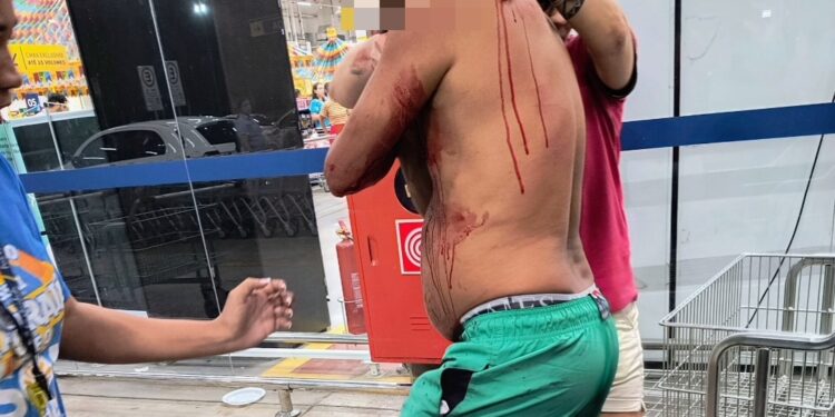 Homem é atingido por golpes de faca no pescoço dentro de supermercado na capital