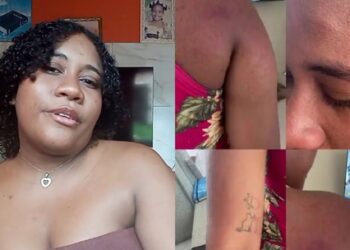 Jovem grávida agredida diz que ficou com sequelas, 50% de perda auditiva após agressão em Paço do Lumiar