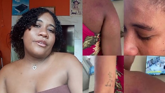 Jovem grávida agredida diz que ficou com sequelas, 50% de perda auditiva após agressão em Paço do Lumiar